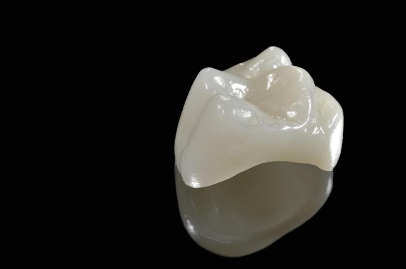 Porcelain Crowns Surrey, BC